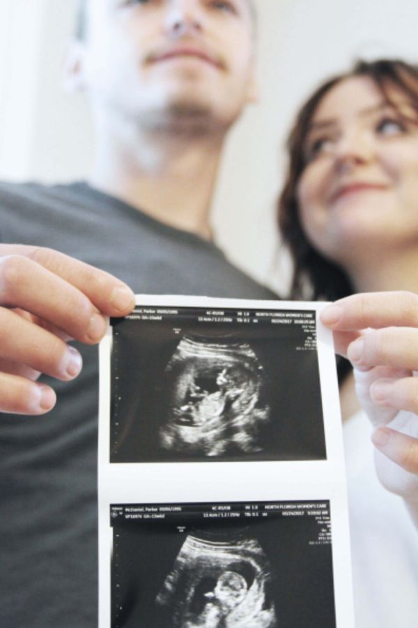 Ectopic Pregnancy